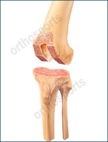 knee bonecuts
