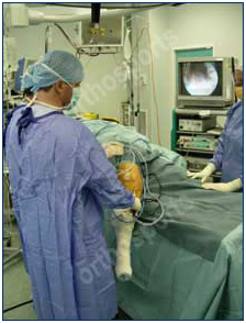 arthroscopy-2